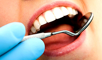 Dientes Mexico